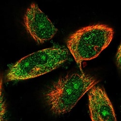 CCBL2 Antibody, Novus Biologicals 25 &mu;L; Unlabeled:Antibodies, Polyclonal